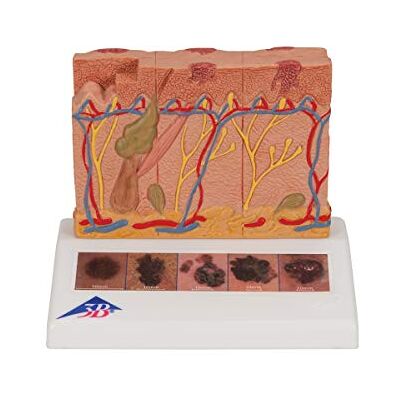 3B Scientific Menschliche Anatomie Hautkrebs-Modell + kostenlose Anatomie App 3B Smart Anatomy, J15 3B Scientific Menschliche Anatomie Hautkrebs-Modell + kostenlose Anatomie App 3B Smart Anatomy, J15