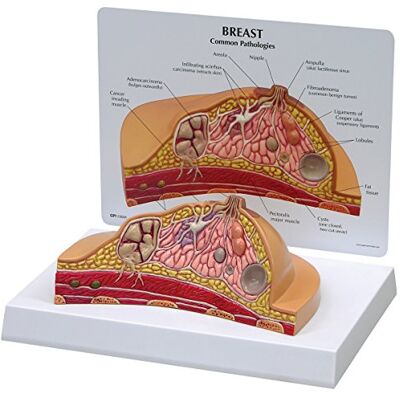 3B Scientific GPI Anatomicals W33351 Brust Modell Querschnitt 3B Scientific GPI Anatomicals W33351 Brust Modell Querschnitt