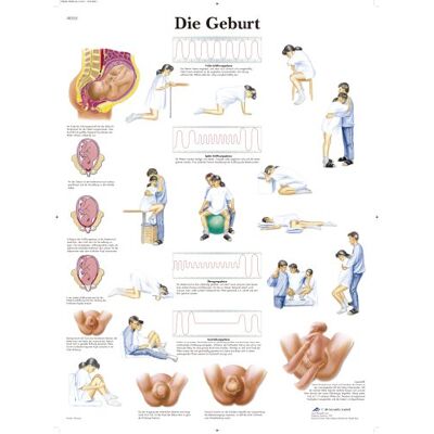 3B Scientific Kalibr poszter – Szülés - Poszter 3B Scientific Kalibr poszter – Szülés - Poszter