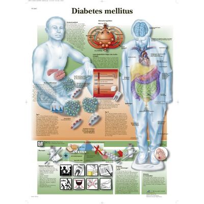 3B Scientific Lehrtafel laminiert Diabetes melllitus 3B Scientific Lehrtafel laminiert Diabetes melllitus