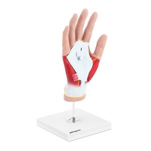 physa Anatomy Model - Hand - Four Pieces - Original Size - Muscle Degeneration