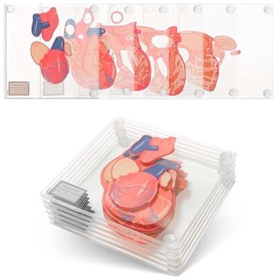 Generix Geek Thinkgeek Anatomic Heart Specimen Coasters (Set of 6) 3D Brain Coaster Set Also Available, Human Anatomy Gifts, Medical Student Gifts, Regalos Para Enfermeras For Medical Students Generix Geek Thinkgeek Anatomic Heart Specimen Coasters (Set of 6) 3D Brain Coaster Set Also Available, Human Anatomy Gifts, Medical Student Gifts, Regalos Para Enfermeras For Medical Students