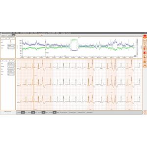 Cardioline Software Per Holter Ecg “cubeholter“ Per Analisi Rapida E Affidabile Di Holter Ecg