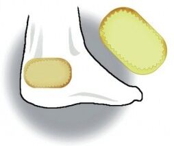 Zanni Cerotto per duroni ovale grande - Cf da 4 pz Zanni Cerotto per duroni ovale grande - Cf da 4 pz