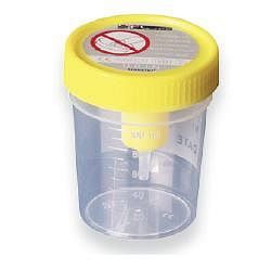 Corman Spa Contenitore Urina Sterile Medipresteril Con Sistema Transfert Per Provette Sottovuoto