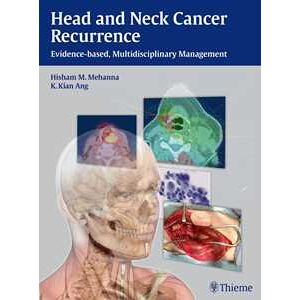 Head And Neck Cancer Recurrence