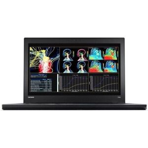 Lenovo Thinkpad P50s I7-6500u 15.6 8 Gb 512 Gb Ssd Fhd M500m Webcam 4g Win 10 Pro De