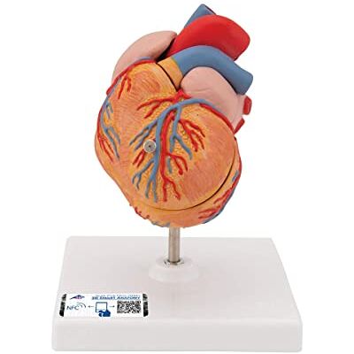 Modello di cuore umano 3B Scientific - Ipertrofia - Modello anatomico Modello di cuore umano 3B Scientific - Ipertrofia - Modello anatomico
