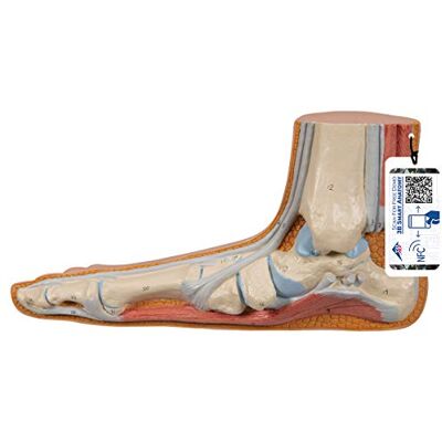 Modello di Piede Piatto (Pes planus) - Ossa, Muscoli & Legamenti Modello di Piede Piatto (Pes planus) - Ossa, Muscoli & Legamenti