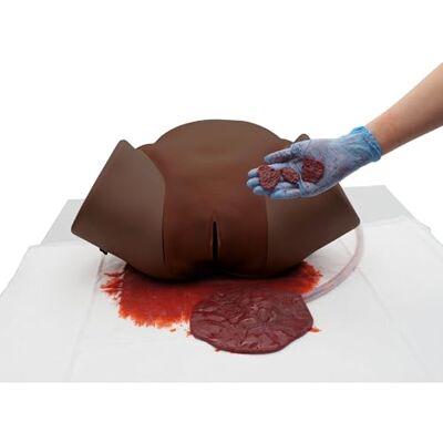 3B Scientific ® Simulatore di Emorragia Postpartum (PPH) – Pelle Scura, Trainer ostetrico per emorragia uterina, rimozione di coaguli e pratica di compressione 3B Scientific ® Simulatore di Emorragia Postpartum (PPH) – Pelle Scura, Trainer ostetrico per emorragia uterina, rimozione di coaguli e pratica di compressione