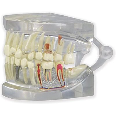 3B Scientific GPI Anatomicals 2861 Mascella Umana con Modello di Denti, Trasparente 3B Scientific GPI Anatomicals 2861 Mascella Umana con Modello di Denti, Trasparente