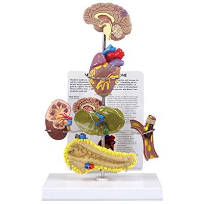 3B Scientific GPI Anatomicals 4020 Modello di Sindrome Metabolica 3B Scientific GPI Anatomicals 4020 Modello di Sindrome Metabolica