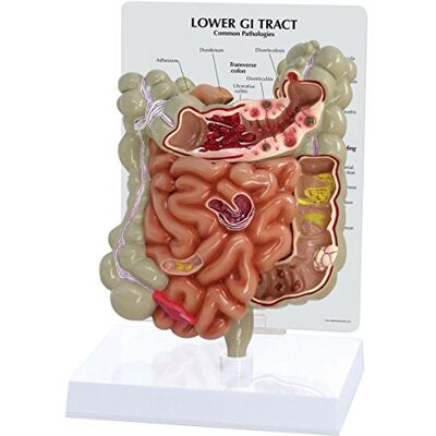 3B Scientific GPI Anatomicals 3342 Modello di Tratto Gastrointestinale 3B Scientific GPI Anatomicals 3342 Modello di Tratto Gastrointestinale