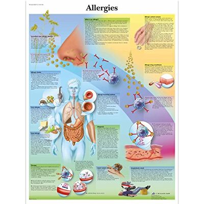 3B Scientific Tavola educativa sulle allergie, sistema immunitario, reazioni allergiche e meccanismi dell'allergia 3B Scientific Tavola educativa sulle allergie, sistema immunitario, reazioni allergiche e meccanismi dell'allergia