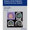 Tumors of the Pediatric Central Nervous System by Robert F Keating (2013-06-07)