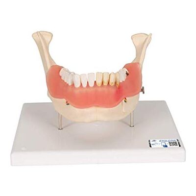 3B Scientific Patologie Dentali, Ingrandito 2 Volte, 21 Pezzi + software gratuito di anatomia 3B Smart Anatomy 3B Scientific Patologie Dentali, Ingrandito 2 Volte, 21 Pezzi + software gratuito di anatomia 3B Smart Anatomy