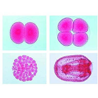 3B Scientific LIEDER Scienze Microscopia Micro preparati Serie SISTEMA DI POTENZIAMENTO corpo e movimento 3B Scientific LIEDER Scienze Microscopia Micro preparati Serie SISTEMA DI POTENZIAMENTO corpo e movimento