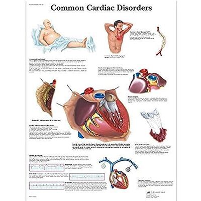 3B Scientific Cardiac comune disturbi della mappa 3B Scientific Cardiac comune disturbi della mappa