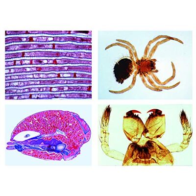 3B Scientific LIEDER Scienze Microscopia Micro preparati Serie Cancro animali, Crust ACEa 3B Scientific LIEDER Scienze Microscopia Micro preparati Serie Cancro animali, Crust ACEa