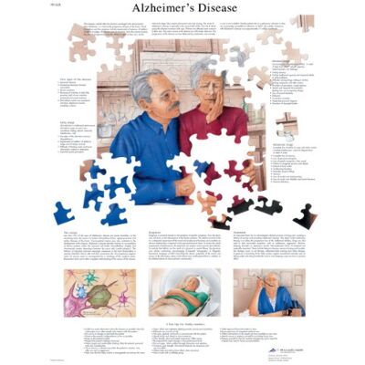 3B Scientific Alzheimer. Grafico, laminated, 1 3B Scientific Alzheimer. Grafico, laminated, 1