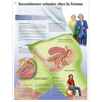 3B Scientific Incontinenza Urinaria Femminile Tavola Didattica Anatomica su Carta, Multicolore, 50 x 67 cm 3B Scientific Incontinenza Urinaria Femminile Tavola Didattica Anatomica su Carta, Multicolore, 50 x 67 cm