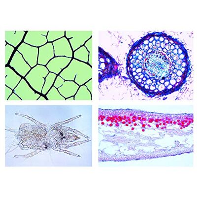 3B Scientific LIEDER Scienze Microscopia Micro preparati Serie ambiente II: Acqua: Le Acque Calme inquinamento 3B Scientific LIEDER Scienze Microscopia Micro preparati Serie ambiente II: Acqua: Le Acque Calme inquinamento