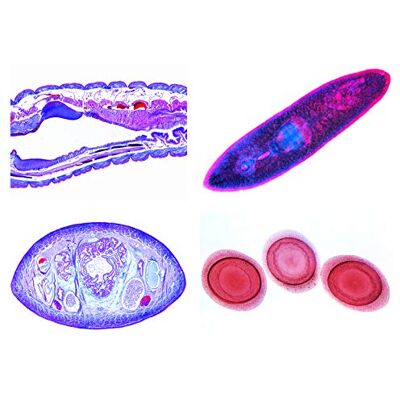 3B Scientific LIEDER Scienze Microscopia Micro preparati Serie Spugne e cava animali, coele, porifera 3B Scientific LIEDER Scienze Microscopia Micro preparati Serie Spugne e cava animali, coele, porifera