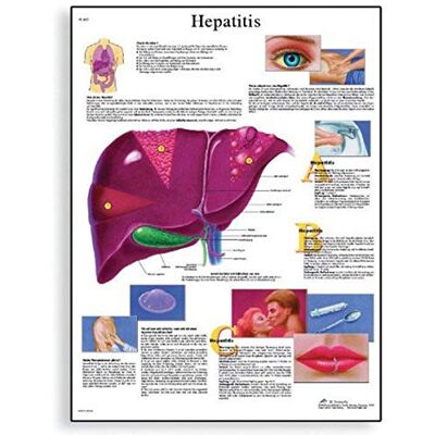 3B Scientific Epatite Chart, unlaminated 3B Scientific Epatite Chart, unlaminated