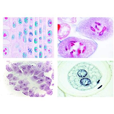 3B Scientific LIEDER Micropreparazione serie mitosi e meiosi serie 1 3B Scientific LIEDER Micropreparazione serie mitosi e meiosi serie 1