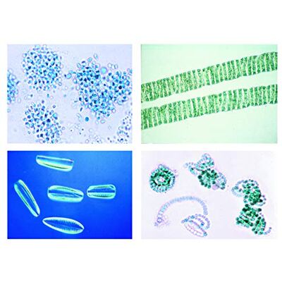 3B Scientific LIEDER Scienze Microscopia Micro preparati Serie ambiente I: foresta: Ursache & Azione di foresta danni 3B Scientific LIEDER Scienze Microscopia Micro preparati Serie ambiente I: foresta: Ursache & Azione di foresta danni