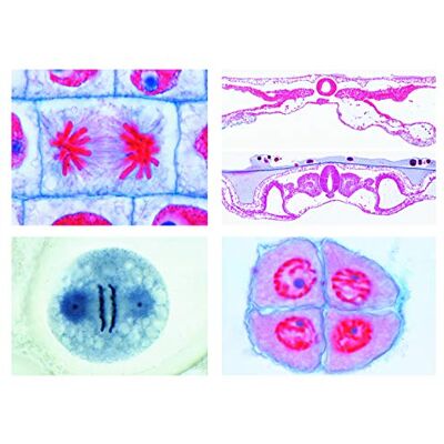 3B Scientific LIEDER Scienze Microscopia Micro preparati Serie Hormone e hormon funzioni 3B Scientific LIEDER Scienze Microscopia Micro preparati Serie Hormone e hormon funzioni
