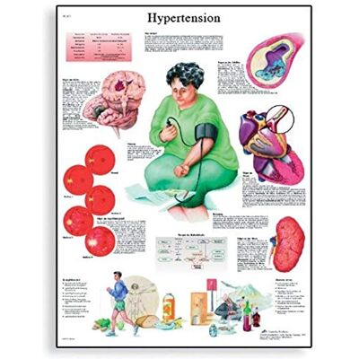 3B Scientific Tabella ipertensione scientifica 3B Scientific Tabella ipertensione scientifica