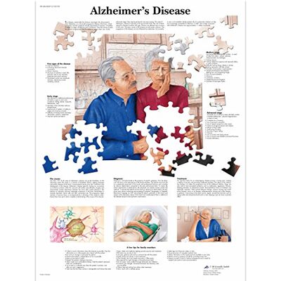 3B Scientific Alzheimer malattia grafico 3B Scientific Alzheimer malattia grafico