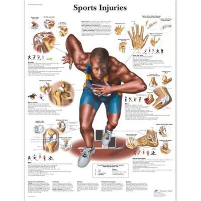 3B Scientific – Laminato Infortuni Sportivi Poster – Poster di Anatomia Protetto da UV e Polvere per Studio, Insegnamento e Cliniche 3B Scientific – Laminato Infortuni Sportivi Poster – Poster di Anatomia Protetto da UV e Polvere per Studio, Insegnamento e Cliniche