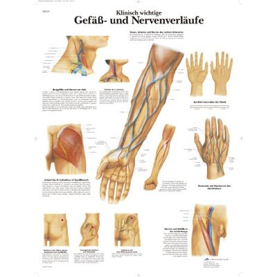 3B Scientific kawe lavagna vasi e clinicamente importanti verläufe nervoso, 1 3B Scientific kawe lavagna vasi e clinicamente importanti verläufe nervoso, 1