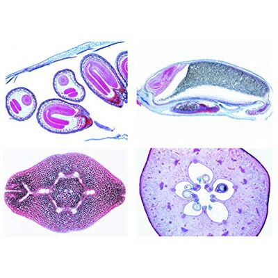3B Scientific LIEDER Scienze Microscopia Micro preparati Serie Fiori di piante, magnoli: Fiore 3B Scientific LIEDER Scienze Microscopia Micro preparati Serie Fiori di piante, magnoli: Fiore