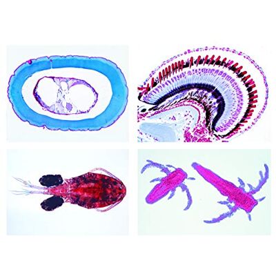 3B Scientific LIEDER Scienze Microscopia Micro preparati Serie verme, Casco inthes 3B Scientific LIEDER Scienze Microscopia Micro preparati Serie verme, Casco inthes