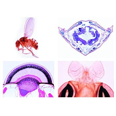 3B Scientific LIEDER Scienze Microscopia Micro preparati Serie spinnentiere e tausendfuessler 3B Scientific LIEDER Scienze Microscopia Micro preparati Serie spinnentiere e tausendfuessler