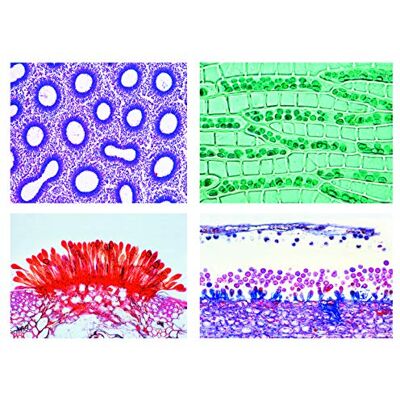 3B Scientific LIEDER Scienze Microscopia Micro preparati Serie Fiori sfuso Piante, Crypt ogamae: Base Serie 3B Scientific LIEDER Scienze Microscopia Micro preparati Serie Fiori sfuso Piante, Crypt ogamae: Base Serie