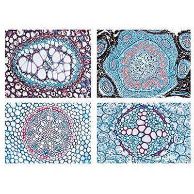 3B Scientific LIEDER Scienze Microscopia Micro preparati Serie Fiore Piante, phaner ogamae: Complemento Serie 3B Scientific LIEDER Scienze Microscopia Micro preparati Serie Fiore Piante, phaner ogamae: Complemento Serie