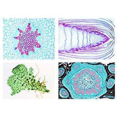 3B Scientific LIEDER Scienze Microscopia Micro preparati Serie Foglie e lebermoose, bryophyta, March antiophyta 3B Scientific LIEDER Scienze Microscopia Micro preparati Serie Foglie e lebermoose, bryophyta, March antiophyta