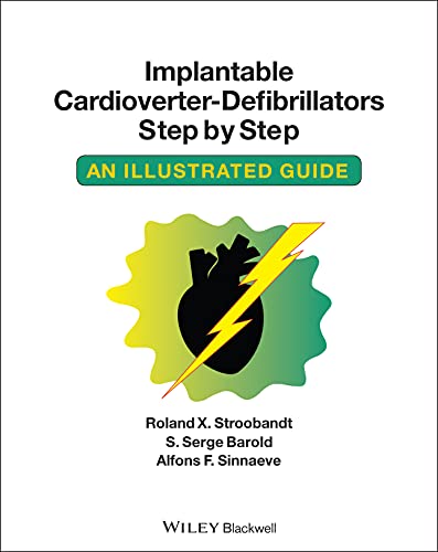 Roland Implantable Cardioverter-Defibrillators Step by Step: An Illustrated Guide