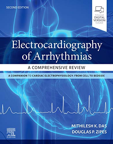 K&M Electrocardiography of Arrhythmias: A Comprehensive Review