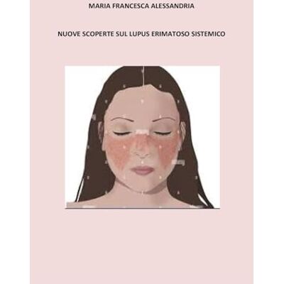 Alessandria, Maria Francesca Nuove scoperte sul lupus erimatoso sistemico Alessandria, Maria Francesca Nuove scoperte sul lupus erimatoso sistemico