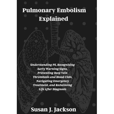 Jackson Pulmonary Embolism Explained: Understanding PE, Recognizing Early Warning Signs, Preventing Deep Vein Thrombosis and Blood Clots, Navigating Emergency Treatment, and Reclaiming Life After Diagnosis Jackson Pulmonary Embolism Explained: Understanding PE, Recognizing Early Warning Signs, Preventing Deep Vein Thrombosis and Blood Clots, Navigating Emergency Treatment, and Reclaiming Life After Diagnosis