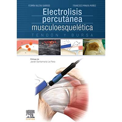 Elsevier Electrolisis percutánea musculoesquelética. Tendón y bursa Elsevier Electrolisis percutánea musculoesquelética. Tendón y bursa