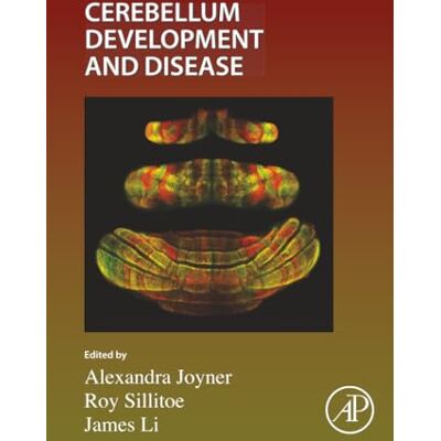 Elsevier Cerebellum Development and Disease: Volume 167 Elsevier Cerebellum Development and Disease: Volume 167