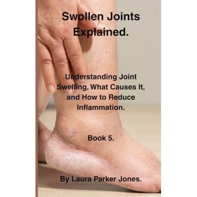 Parker Swollen Joints Explained.: Understanding Joint Swelling, Inflammation, and What It Means. Book 5. Parker Swollen Joints Explained.: Understanding Joint Swelling, Inflammation, and What It Means. Book 5.