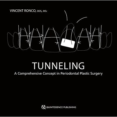 Vincent Tunneling: A Comprehensive Concept in Periodontal Plastic Surgery Vincent Tunneling: A Comprehensive Concept in Periodontal Plastic Surgery