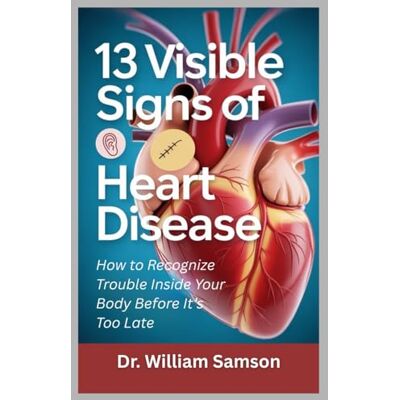 Samson 13 VISIBLE SIGNS OF HEART DISEASE: How to Recognize Trouble Inside Your Body Before It’s Too Late Samson 13 VISIBLE SIGNS OF HEART DISEASE: How to Recognize Trouble Inside Your Body Before It’s Too Late